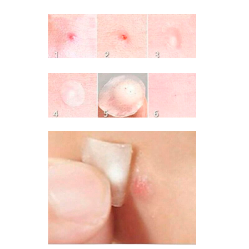 ade5
